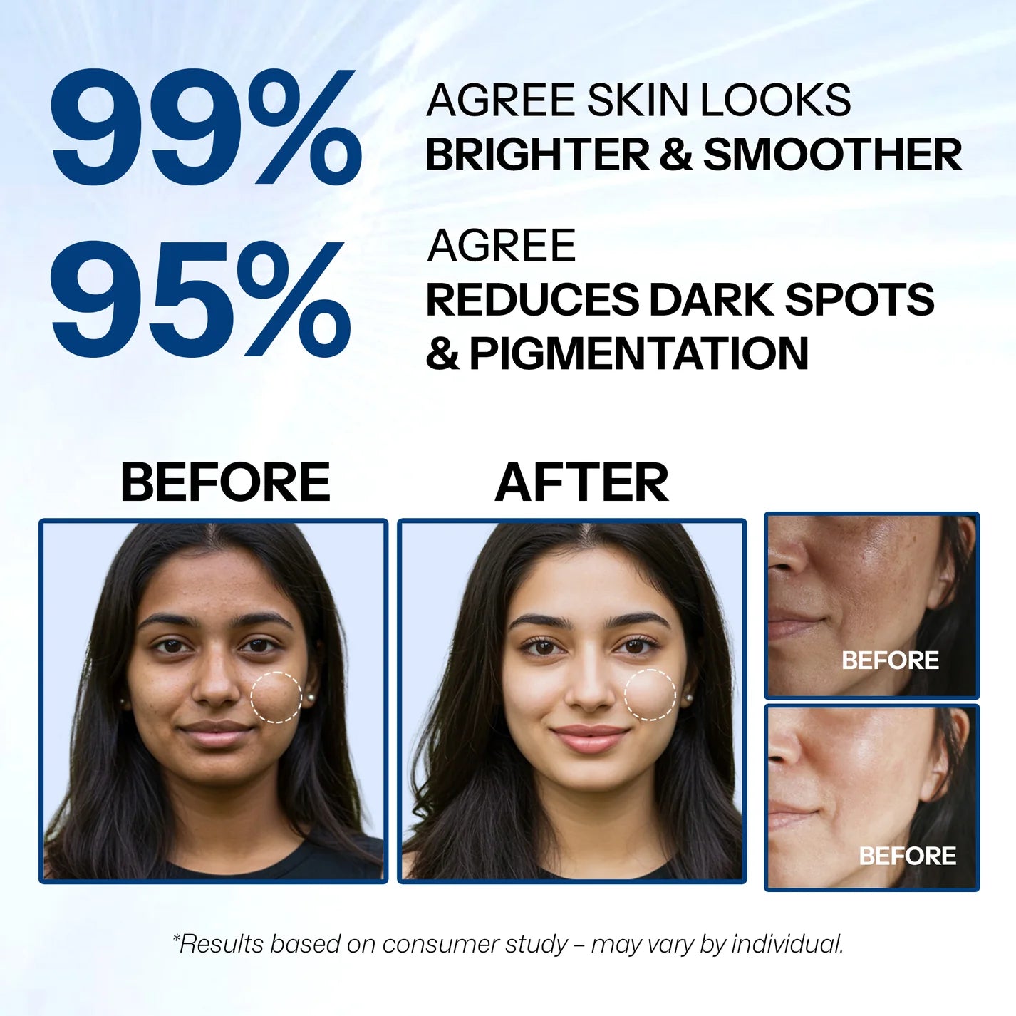 Layer Theory Advanced Skin Brightening Face Cream with Tranexamic Acid 5%, Alpha Arbutin 7% & Niacinamide 5% | Brightens, Repairs & Evens Skin Tone | 30g