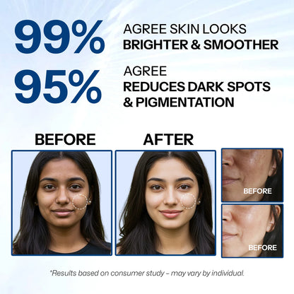 Layer Theory Advanced Skin Brightening Face Cream with Tranexamic Acid 5%, Alpha Arbutin 7% & Niacinamide 5% | Brightens, Repairs & Evens Skin Tone | 30g