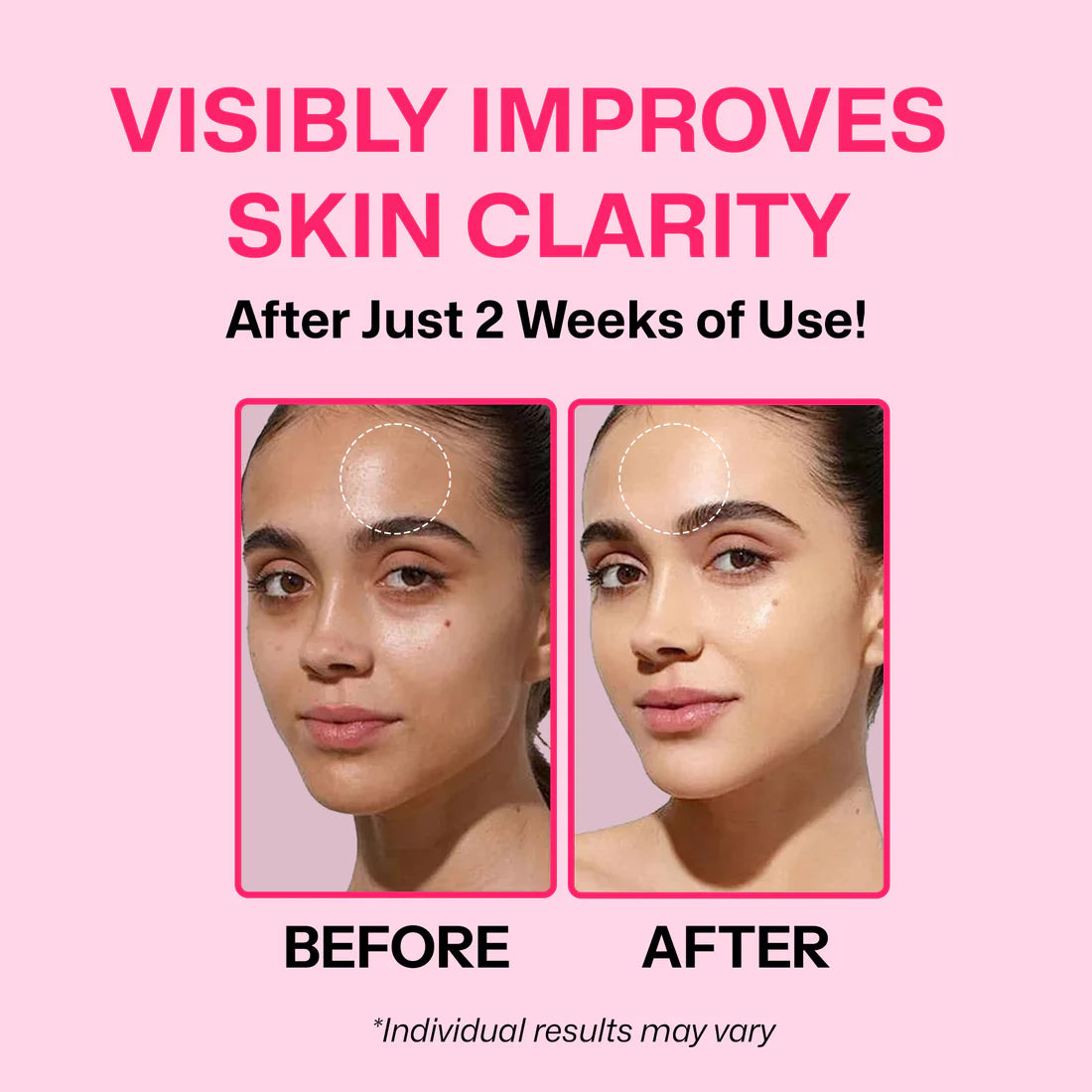 LayerTheory TXA 5% & Niacinamide 10% Face Serum | Brightens Skin, Evens Tone, Fades Dark Spots & Pigmentation